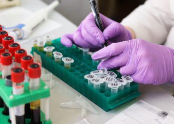 coronavírus teste em laboratório foto: PIXABAY/STOCK PHOTO