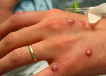 Foto: Reprodução / Internet