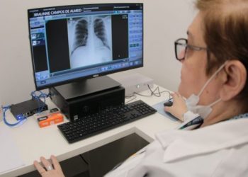 Raio-X - Foto: Divulgação