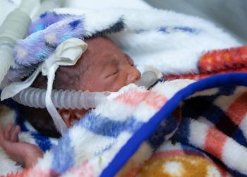 Um bebê prematuro de um dia de vida recebe cuidados vitais 24 horas por dia na unidade de terapia intensiva neonatal de um hospital na Etiópia. - Foto: Unicef:Raphael Pouget