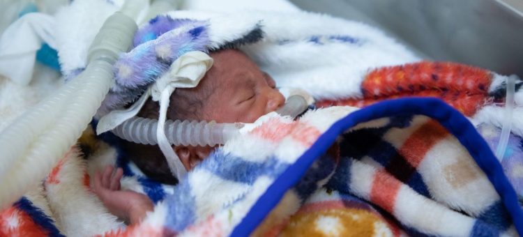 Um bebê prematuro de um dia de vida recebe cuidados vitais 24 horas por dia na unidade de terapia intensiva neonatal de um hospital na Etiópia. - Foto: Unicef:Raphael Pouget