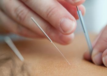 Brasil - Uma mulher recebe tratamento de acupuntura Foto: Unsplash/Katherine Hanlon