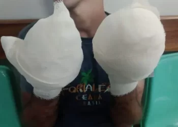 Homem sofreu tortura e perdeu os dedos das mãos – Foto: Reprodução/WhatsApp