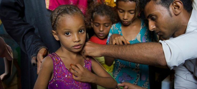No Iêmen, onde uma em cada duas crianças sofre de raquitismo, um profissional de saúde mede crianças pequenas em um vilarejo próximo a Al Hudaydah - Foto: Unocha/Giles Clarke