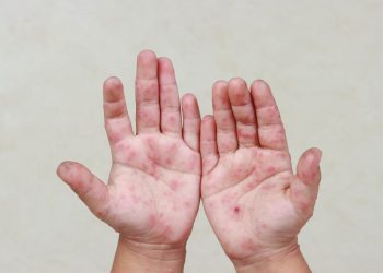 Fotos - Divulgação/Semsa