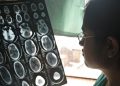 Um médico em Agra, na Índia, examina as imagens de tomografia cerebral de um paciente. Foto: OMS/Rajiv Kumar