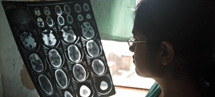 Um médico em Agra, na Índia, examina as imagens de tomografia cerebral de um paciente. Foto: OMS/Rajiv Kumar