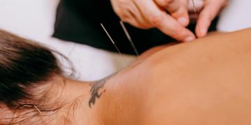 Foto: Reprodução | Canva