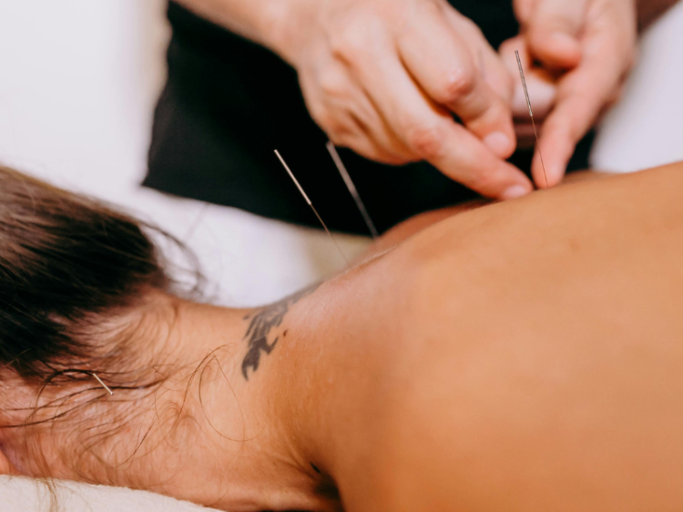 Foto: Reprodução | Canva