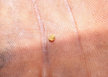 Um garimpeiro segura uma pequena pepita de ouro extraída em Sikasso, no Mali. Foto: OIM/Anna Pujol-Mazzini
